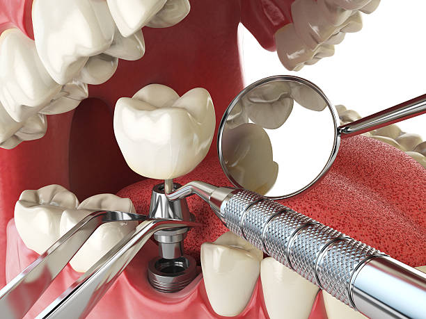 Best Cosmetic Emergency Dentistry in Grayling, MI